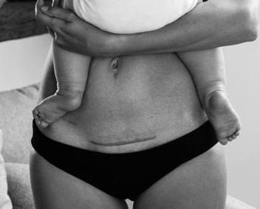 1 an après – Mon corps post-partum